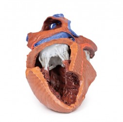 Model serca 3D, budowa wewnętrzna - zdjecie nr: 1
