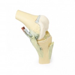 Wydruk  anatomiczny - staw kolanowy w pozycji zgięciowej - zdjecie nr: 1