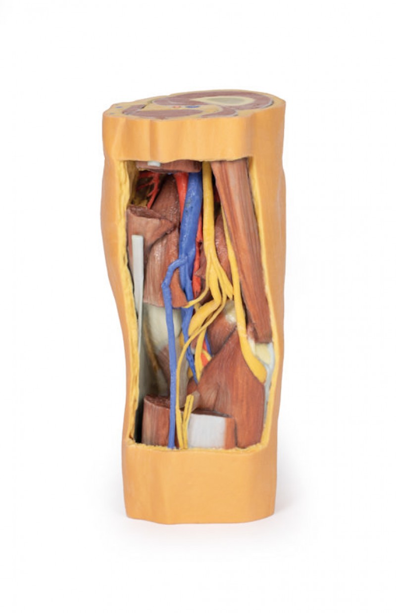 Wydruk  anatomiczny 3D - dół podkolanowy - zdjecie nr: 1
