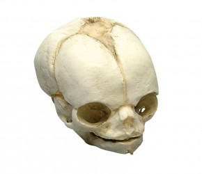 Model czaszki płodu, 21 ½ tygodnia - zdjecie nr: 1